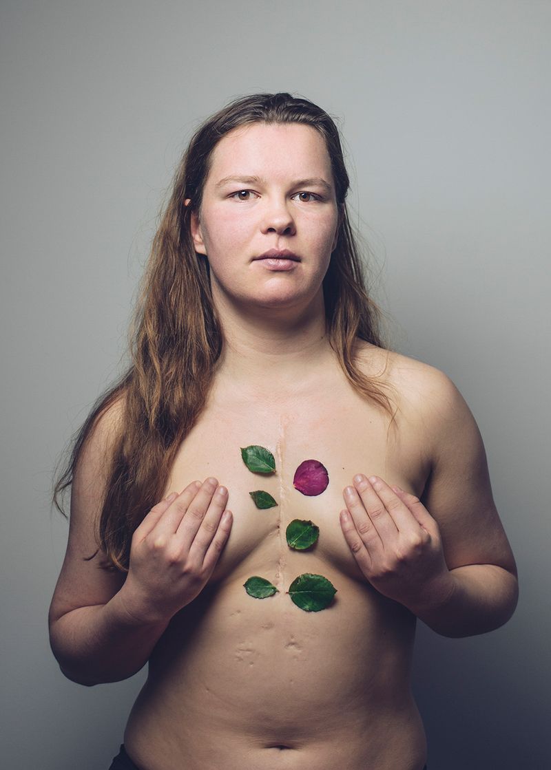 © Gery ten Broek - MERLIJN Merlin was born with a heart defect, tricuspid discomfort and has since undergone three surgeries