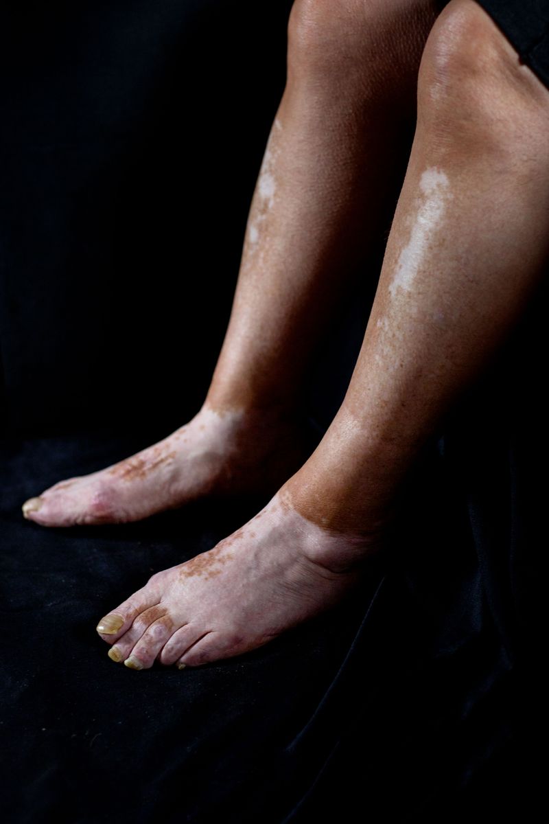 © Ana Nuñez Rodriguez - Roots-II