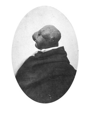 Cooking Potato Stories