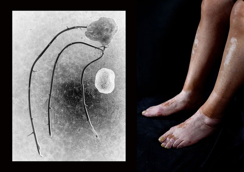 © Ana Nuñez Rodriguez - Commonalities II