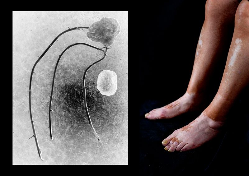 © Ana Nuñez Rodriguez - Commonalities II