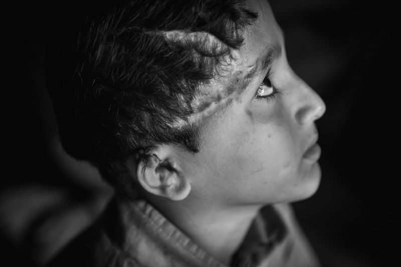 © David Verberckt - Image from the Survivors of a Silent Genocide photography project