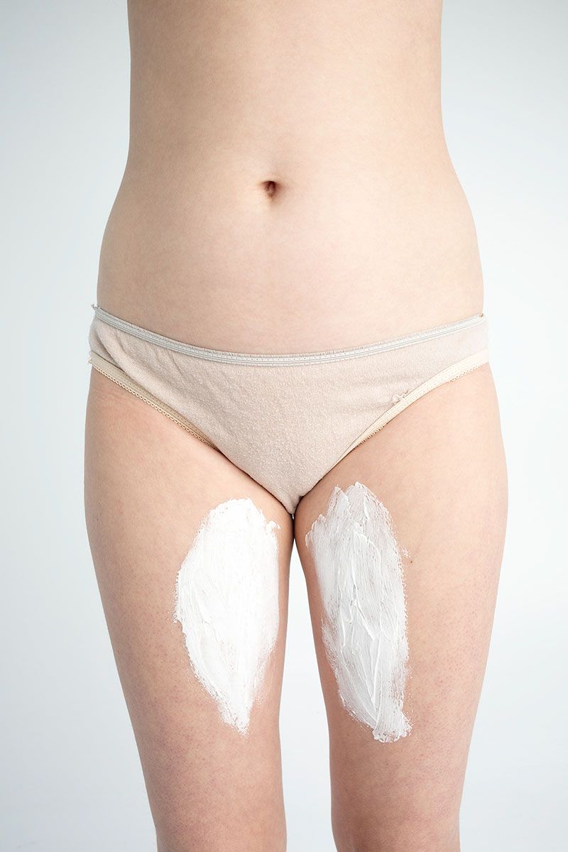 © Ola Walków - my scars