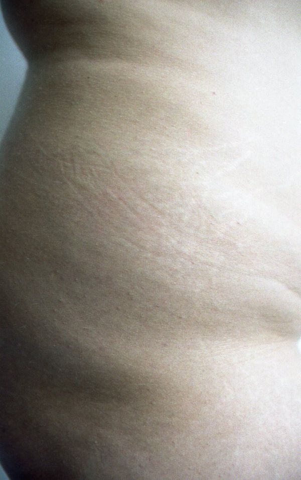 © Ida M U Vengberg - Image from the Uden Filter photography project