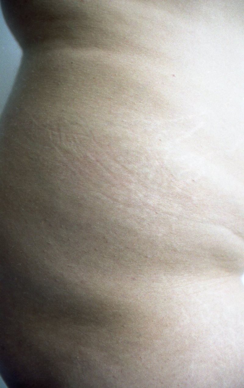 © Ida M U Vengberg - Image from the Uden Filter photography project