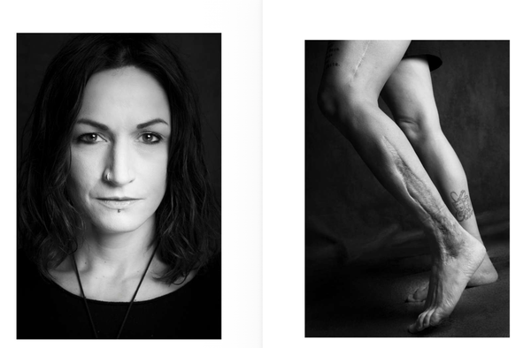 © Niccolò Zorza - Image from the Cicatrici (Scars) Dietro ogni cicatrice c'è un racconto. Behind every scars there is a story. photography project