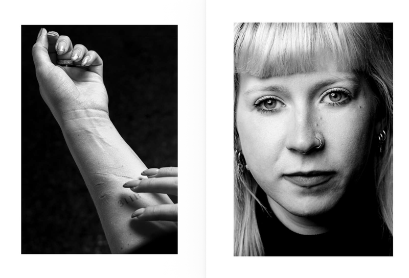 © Niccolò Zorza - Image from the Cicatrici (Scars) Dietro ogni cicatrice c'è un racconto. Behind every scars there is a story. photography project