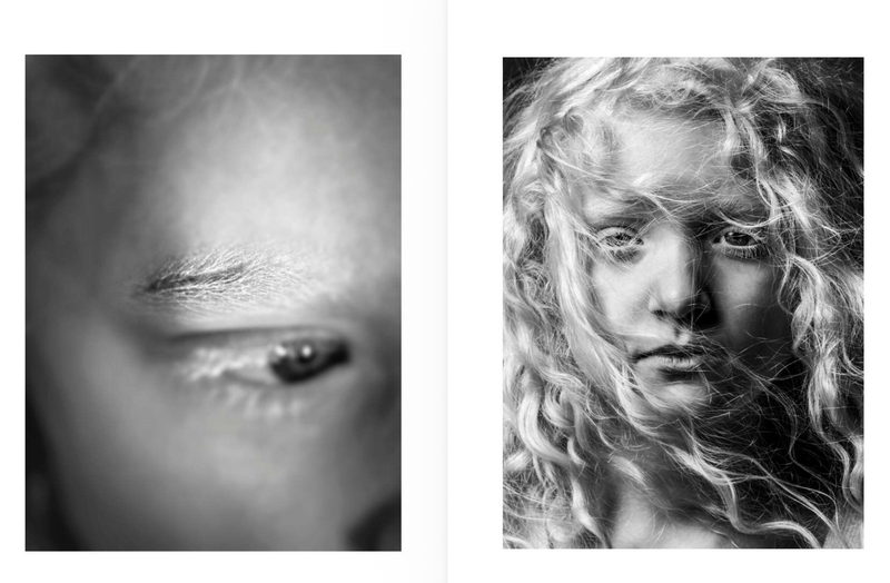 © Niccolò Zorza - Image from the Cicatrici (Scars) Dietro ogni cicatrice c'è un racconto. Behind every scars there is a story. photography project