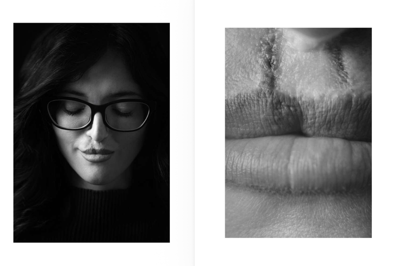© Niccolò Zorza - Image from the Cicatrici (Scars) Dietro ogni cicatrice c'è un racconto. Behind every scars there is a story. photography project