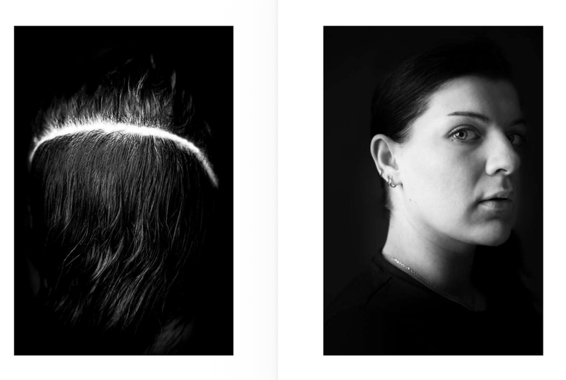© Niccolò Zorza - Image from the Cicatrici (Scars) Dietro ogni cicatrice c'è un racconto. Behind every scars there is a story. photography project