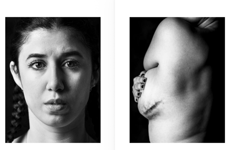 © Niccolò Zorza - Image from the Cicatrici (Scars) Dietro ogni cicatrice c'è un racconto. Behind every scars there is a story. photography project