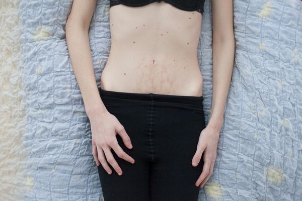 © Mafalda Rakoš - Image from the I want to disappear - approaching eating disorders photography project