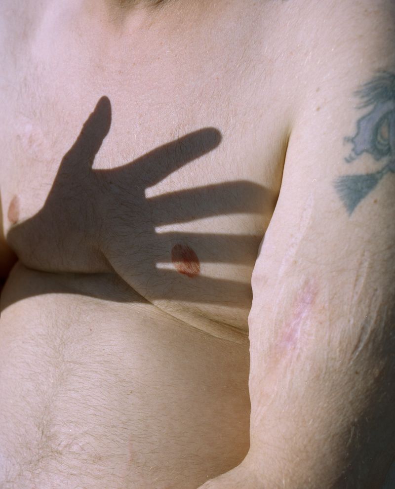 © Mafalda Rakoš - Daniel, a trans*man from Hamburg, formerly affected by Binge Eating disorder. Hamburg, 2019.