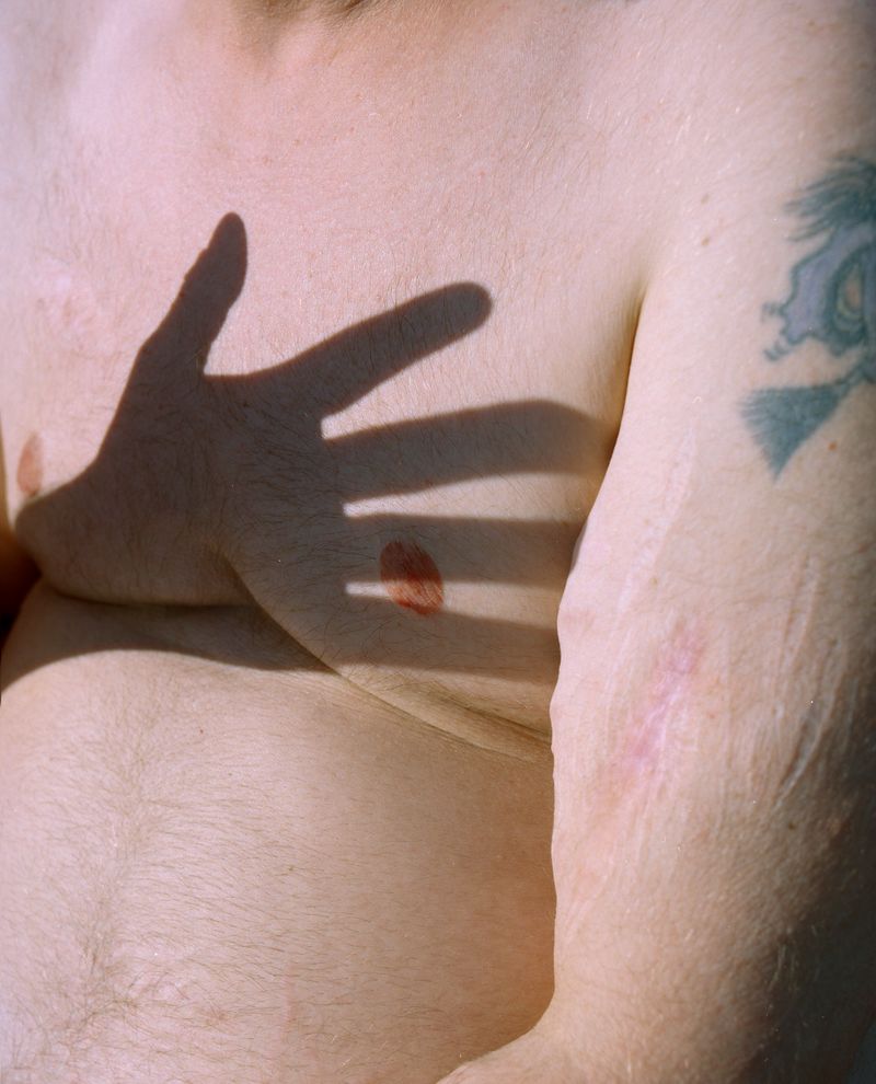 © Mafalda Rakoš - Daniel, a trans*man from Hamburg, formerly affected by Binge Eating disorder. Hamburg, 2019.