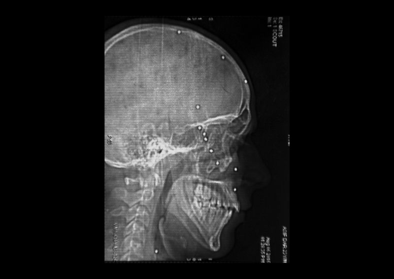 © Camillo Pasquarelli - Image from the THE VALLEY OF SHADOWS photography project