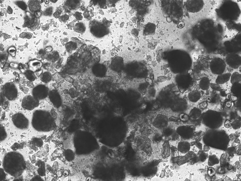 © Yuliana Paranko - antidepressants under a microscope