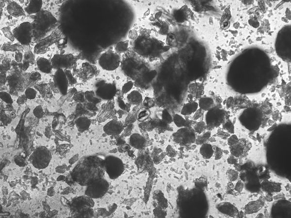© Yuliana Paranko - antidepressants under a microscope