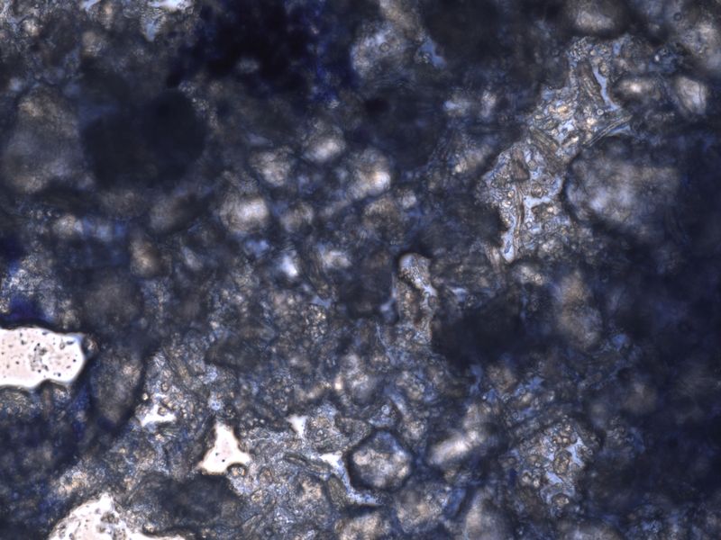 © Yuliana Paranko - antidepressants under a microscope