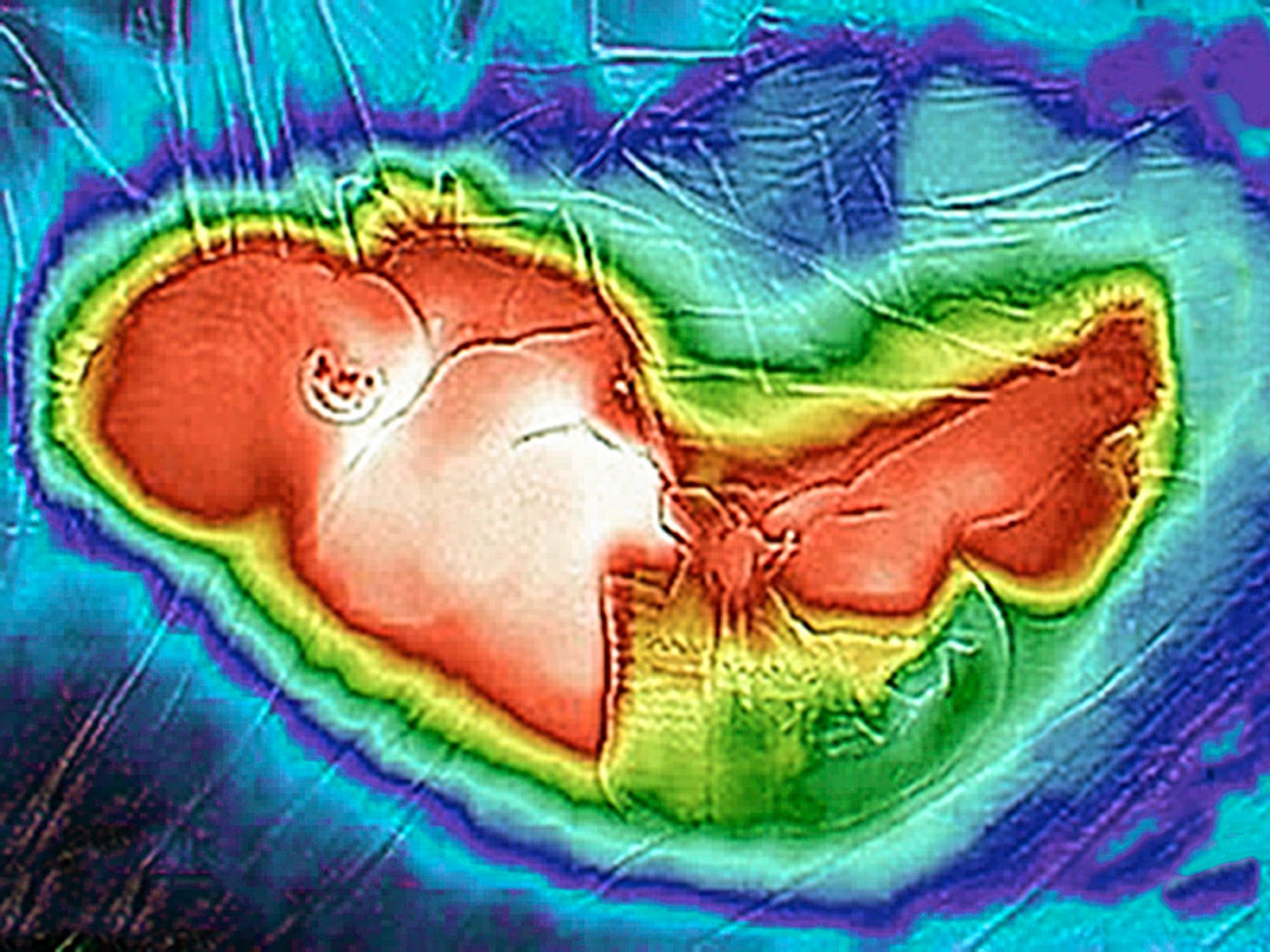 © ROGER GRASAS - Thermographic image of our newborn daughter sleeping