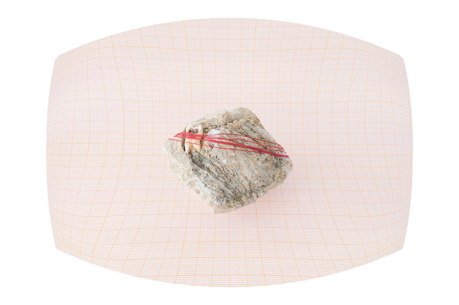 © Panos Charalampidis + Mary Chairetaki - Wisdom tooth. The picture is a product of Focus Stacking (Object view).