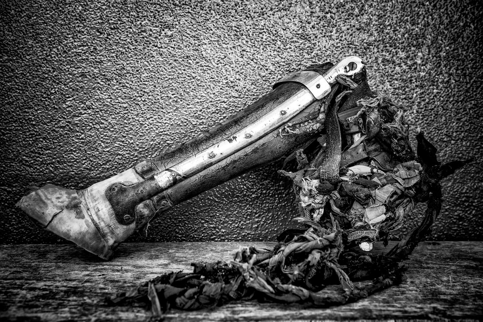 © Jose Silva Pinto - Image from the Lost Limbs photography project