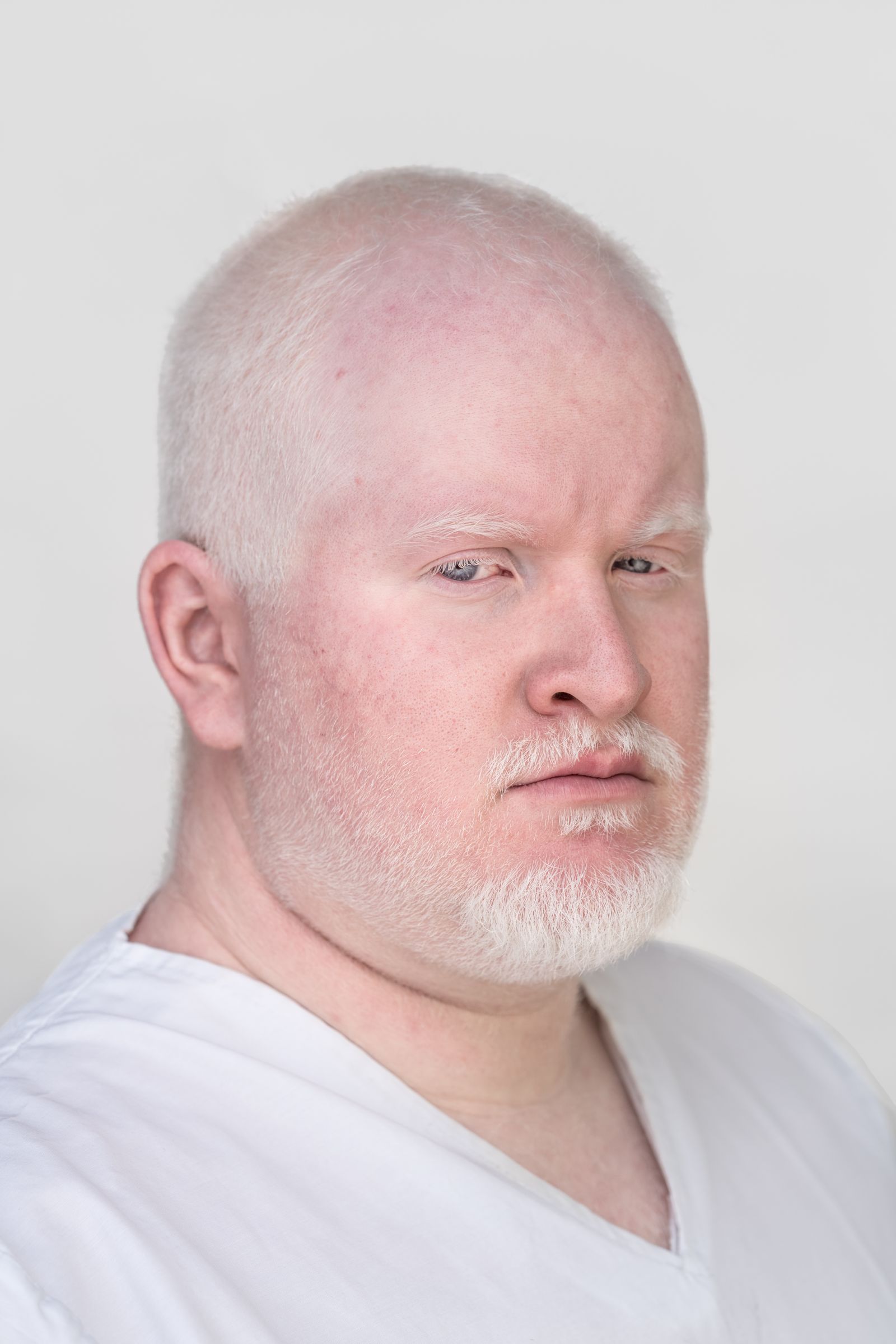© Jorge Monaco - Image from the ALBINOS, BEING DIFFERENT photography project