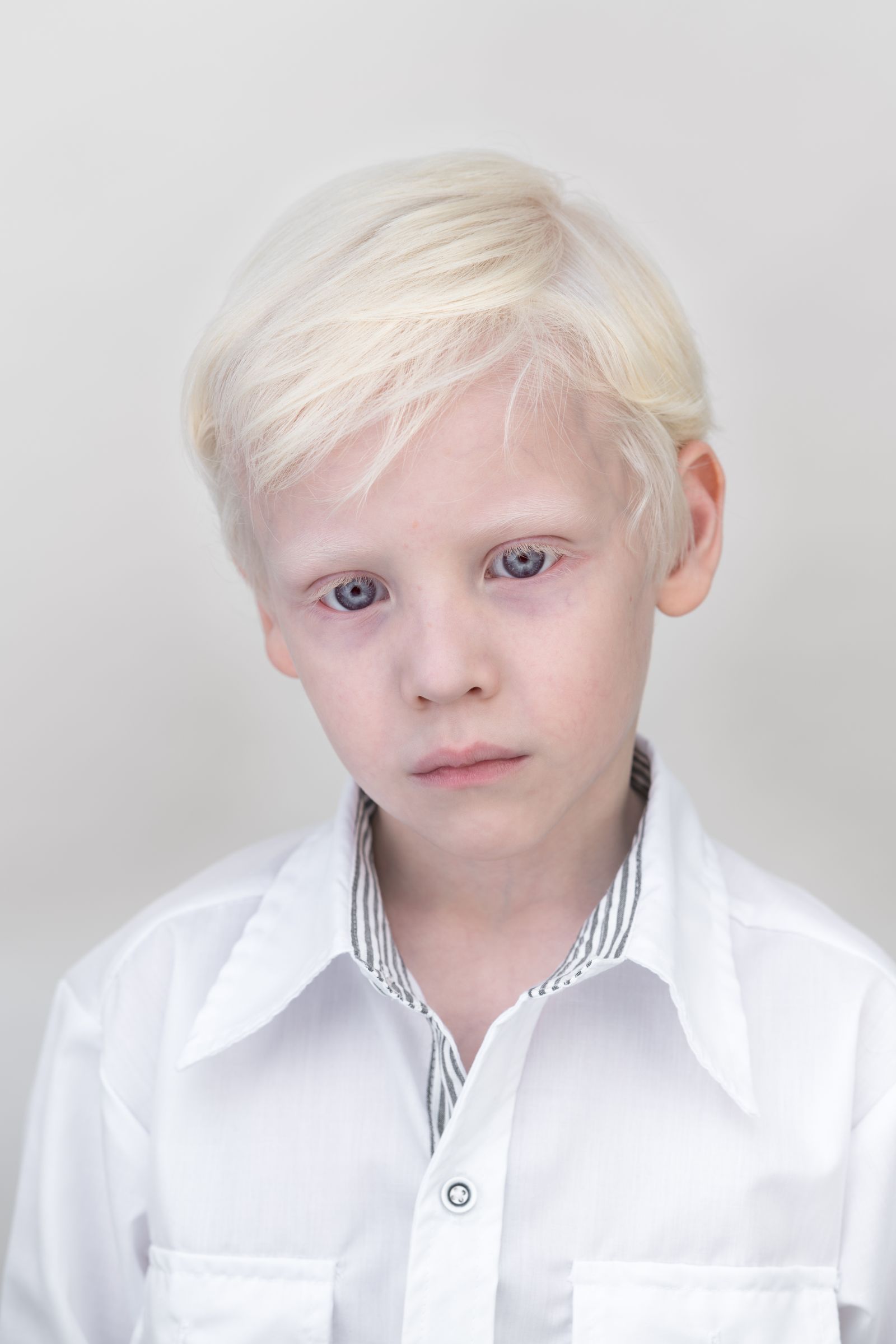 © Jorge Monaco - Image from the ALBINOS, BEING DIFFERENT photography project