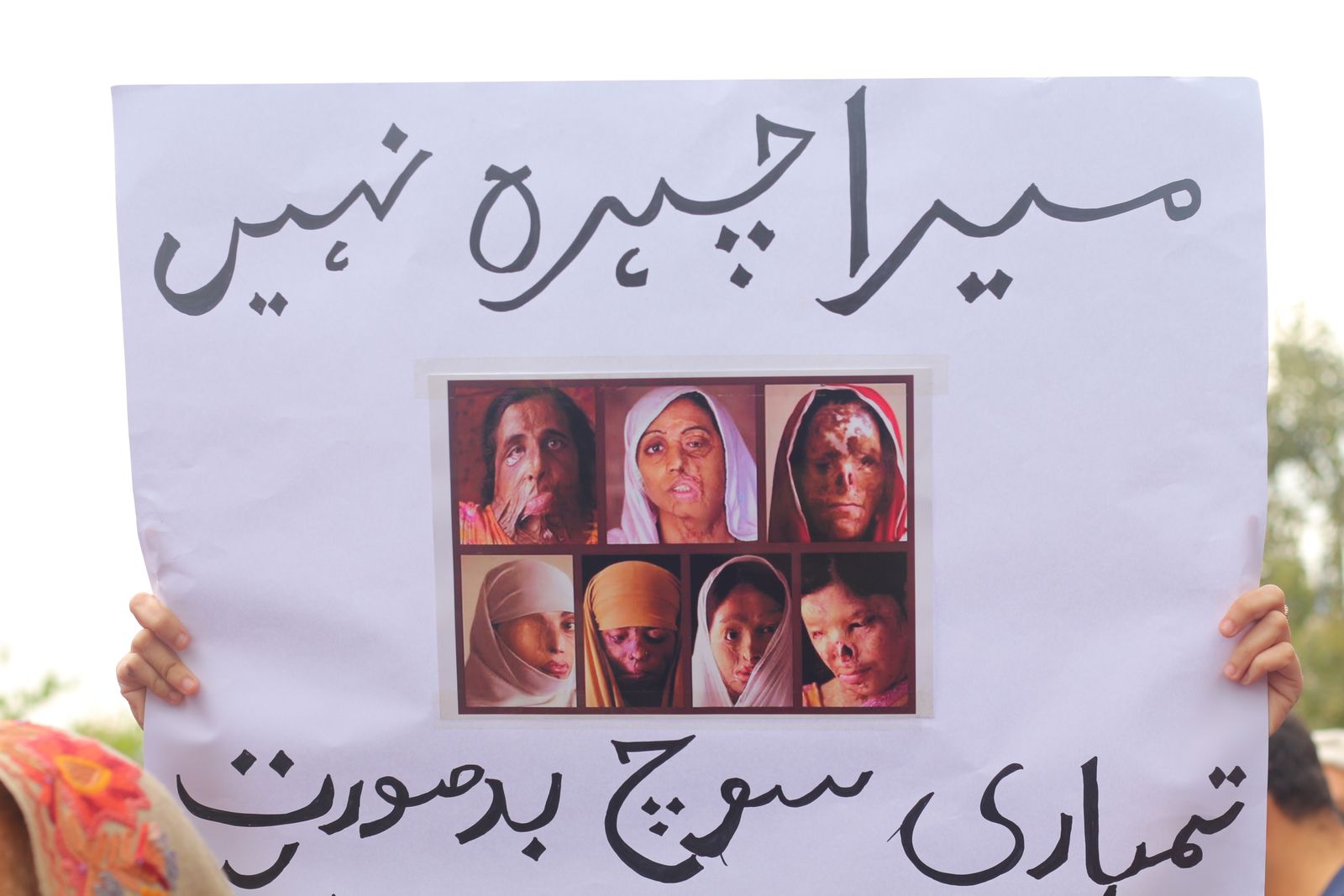 © Maheen Qadri - A placard on domestic violence and acid attack victims. It reads "My face isn't ugly, your thoughts are." Islamabad (2020)