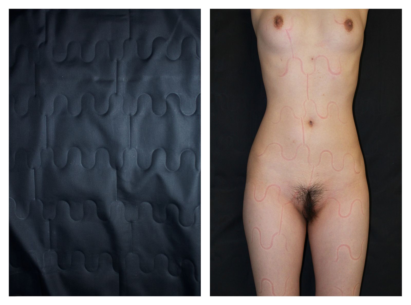 © Joy Li - My skin imprinted by mattress coils
