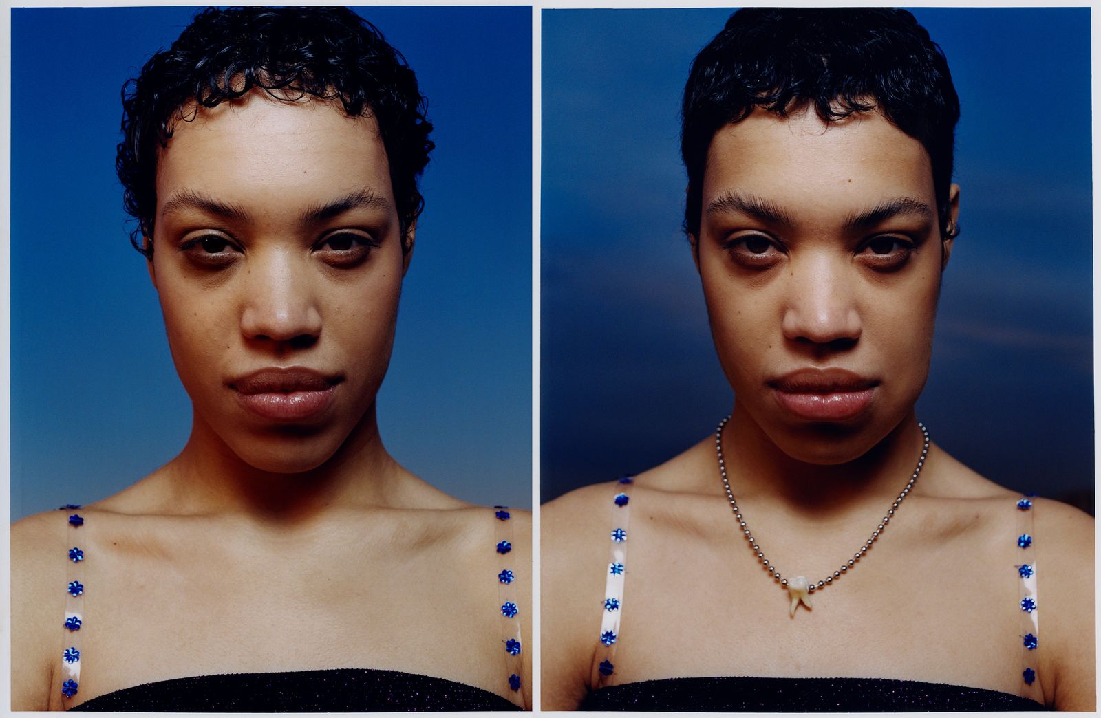© Jara García - 6_Olga before and after the removal of her wisdom tooth