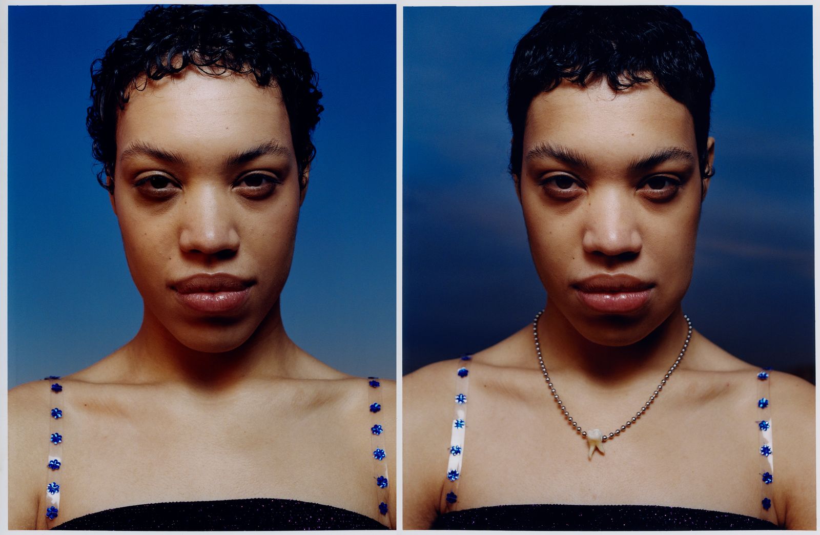 © Jara García - 14_Olga before and after the removal of her wisdom tooth.