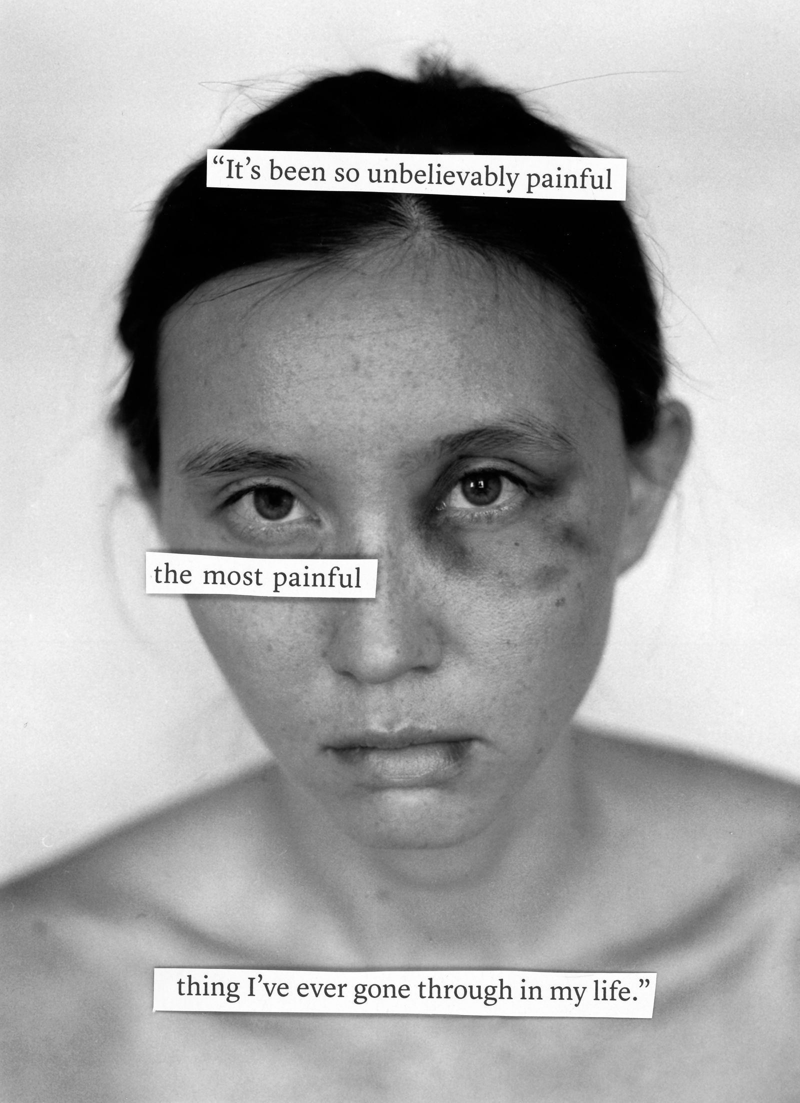 © Kimbra Audrey - the most painful