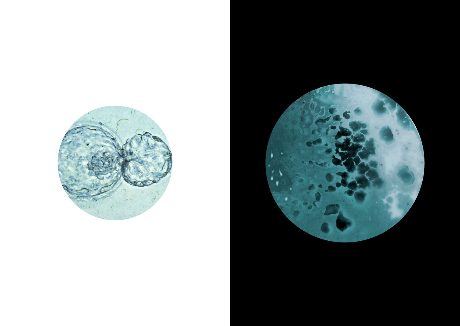 © Miriam Levi - (Right) Chemigram (Left) Found Image, embryo