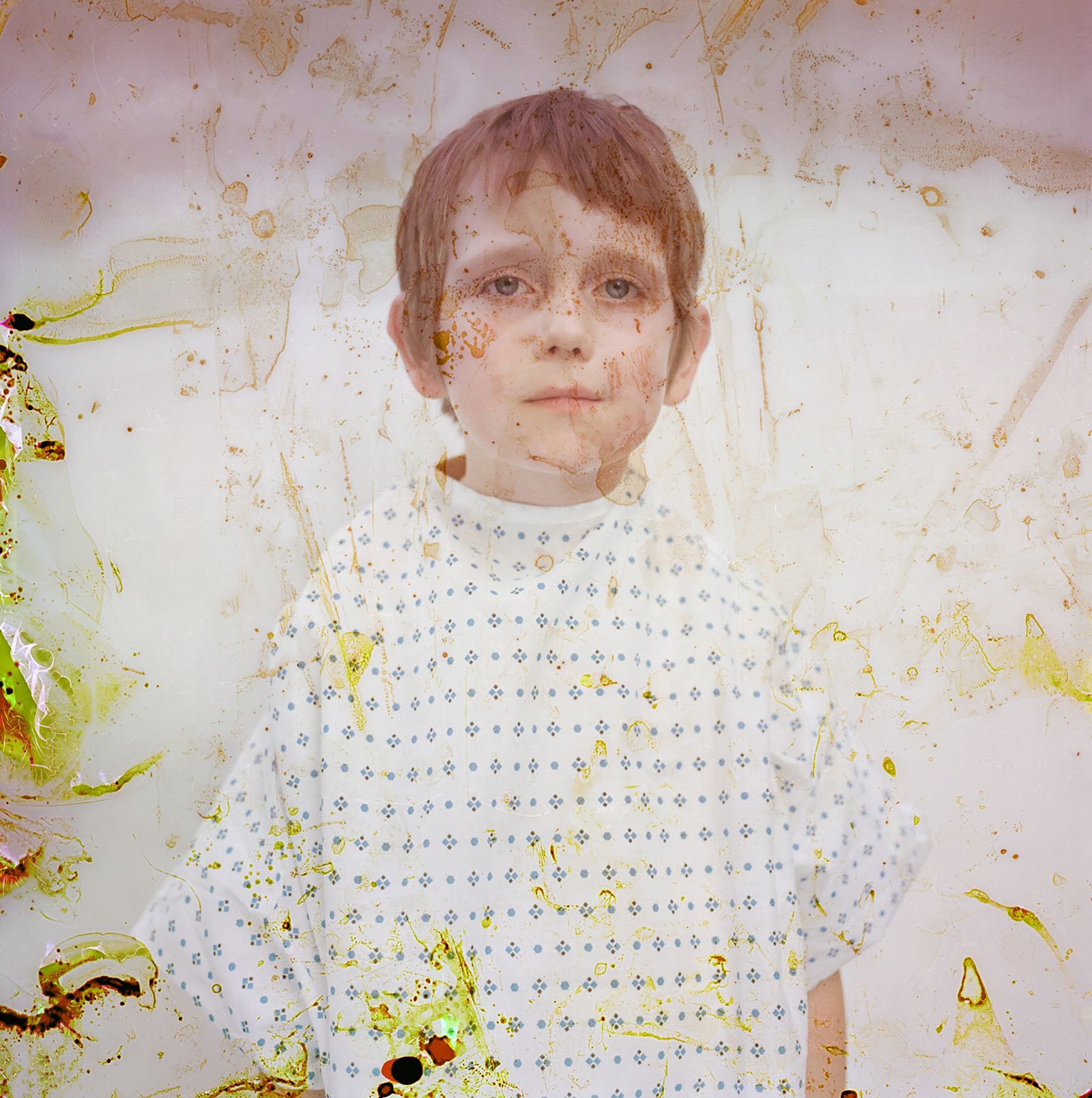 © Rhiannon Adam - Luca, aged 7, vegetarian, May 2018. Kodak Portra 400 film and saliva. Left 3 weeks in the sample before washing.