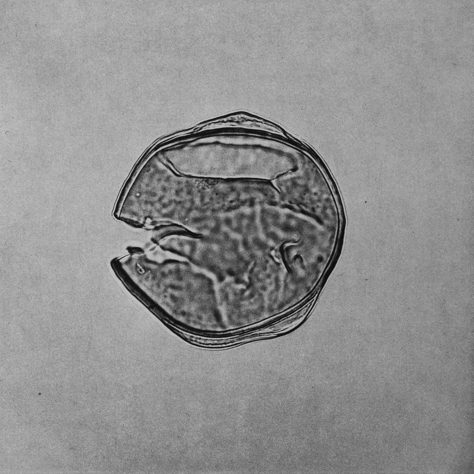 © suzette bousema - Deflandrea convexa From the project 'Dinoflagellates'