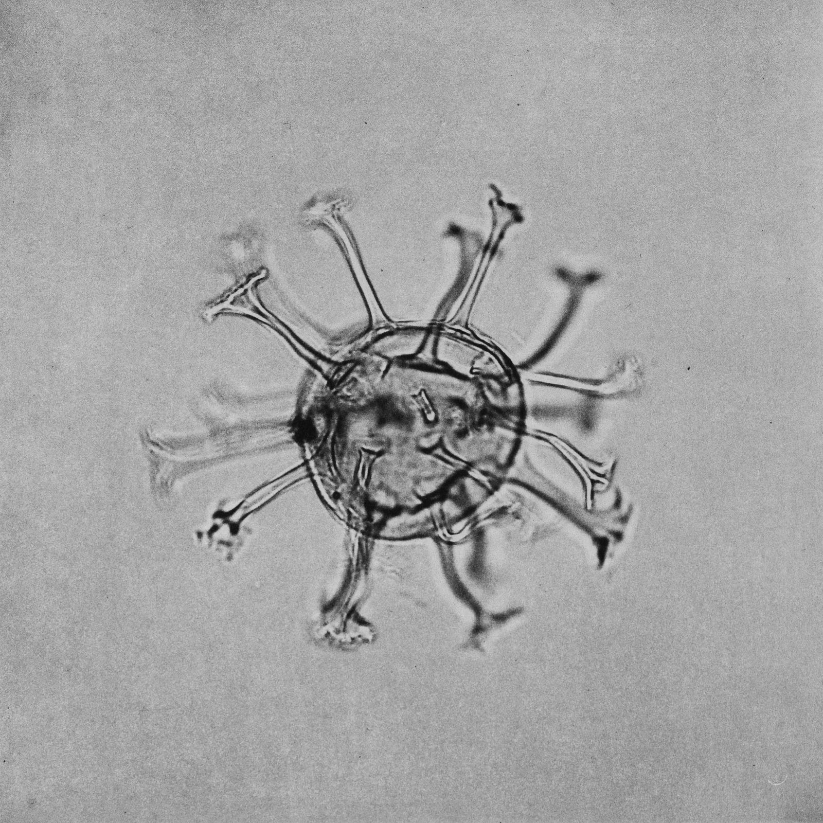 © suzette bousema - Hystrichosphaeridium tubiferum From the project 'Dinoflagellates'