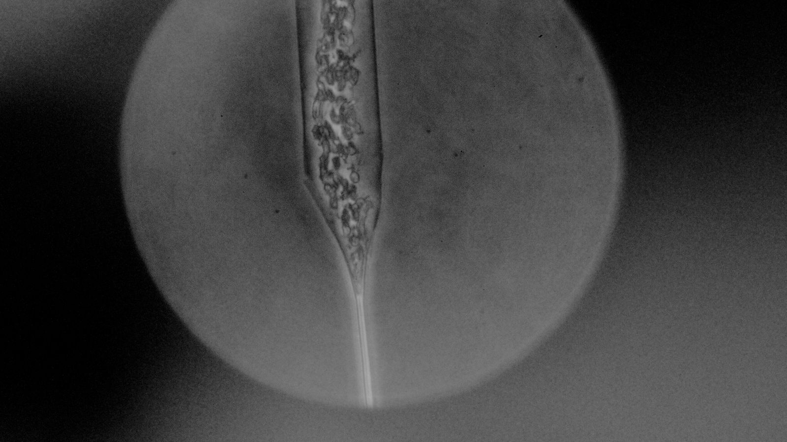 © Akosua Viktoria Adu-Sanyah - phytoplankton species of a water samplee from seno ballena