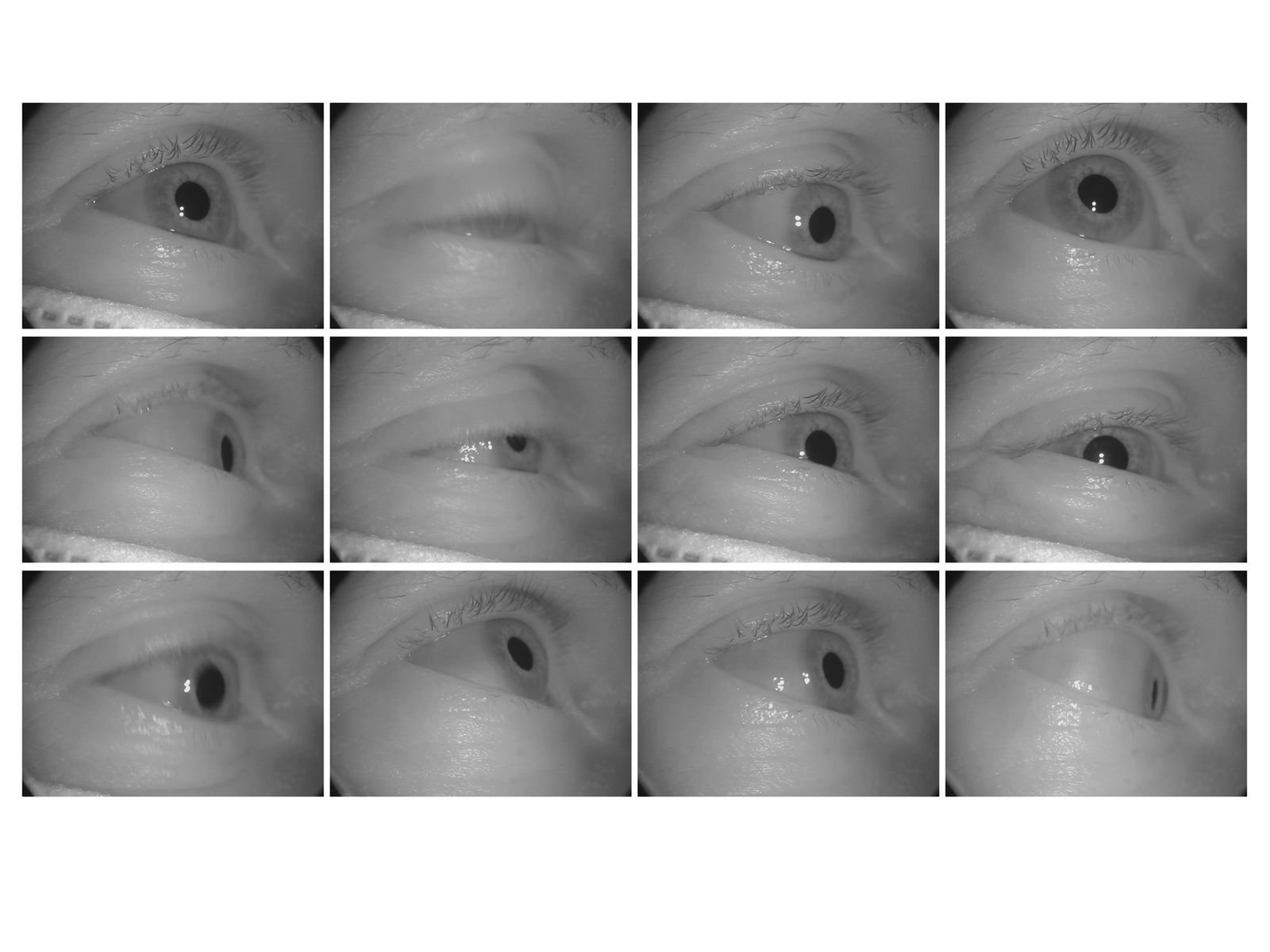 © Mattia Balsamini - Rapid - eye - movement tests at the Center for Chronobiology UPK in Basel.
