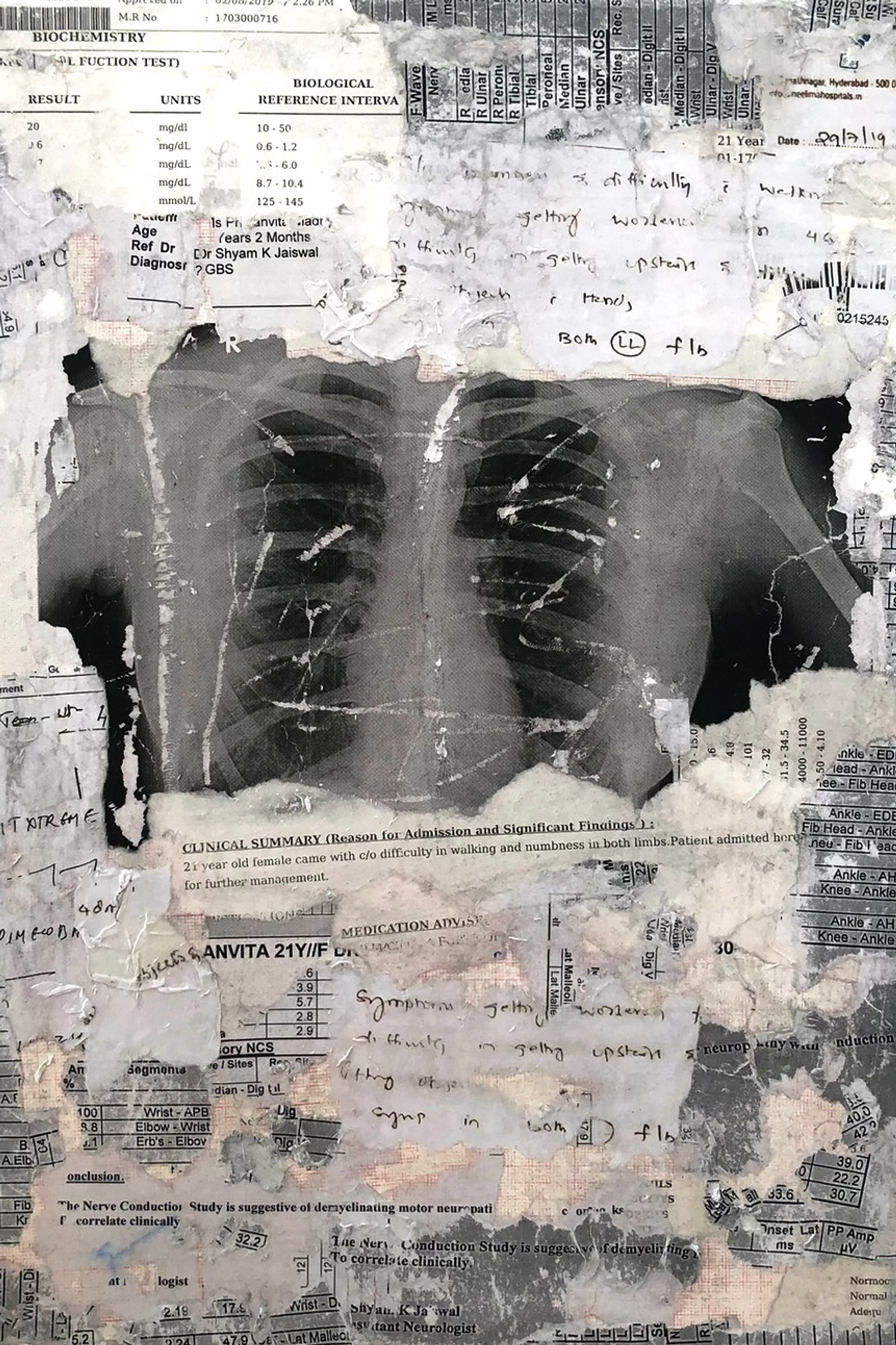 © Phalanvita Madhyala - Canvas as an extension of skin, layered with my own medical reports.