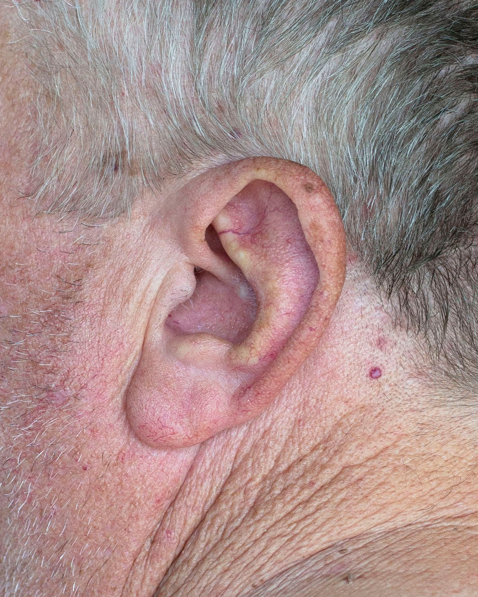 © Chloe Scout Nix - title: dad ear (waxahachie tx). year: 2023 Size: 32x40 in. medium: vinyl print mounted on wood panel