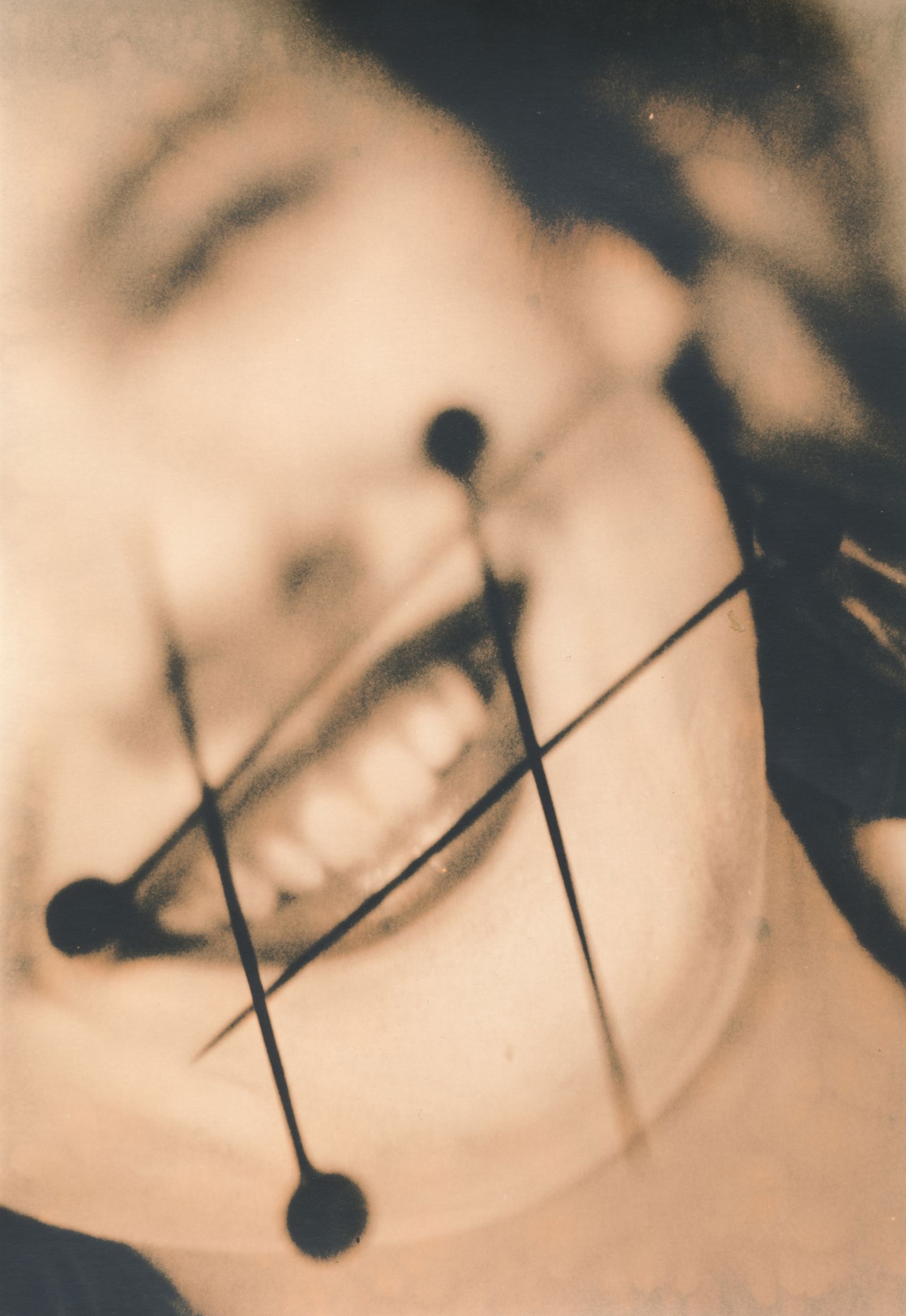 © Jo Stapleton - Mouth with pins. Found 1940s negative rephotographed on a light box with objects added (Lith print)