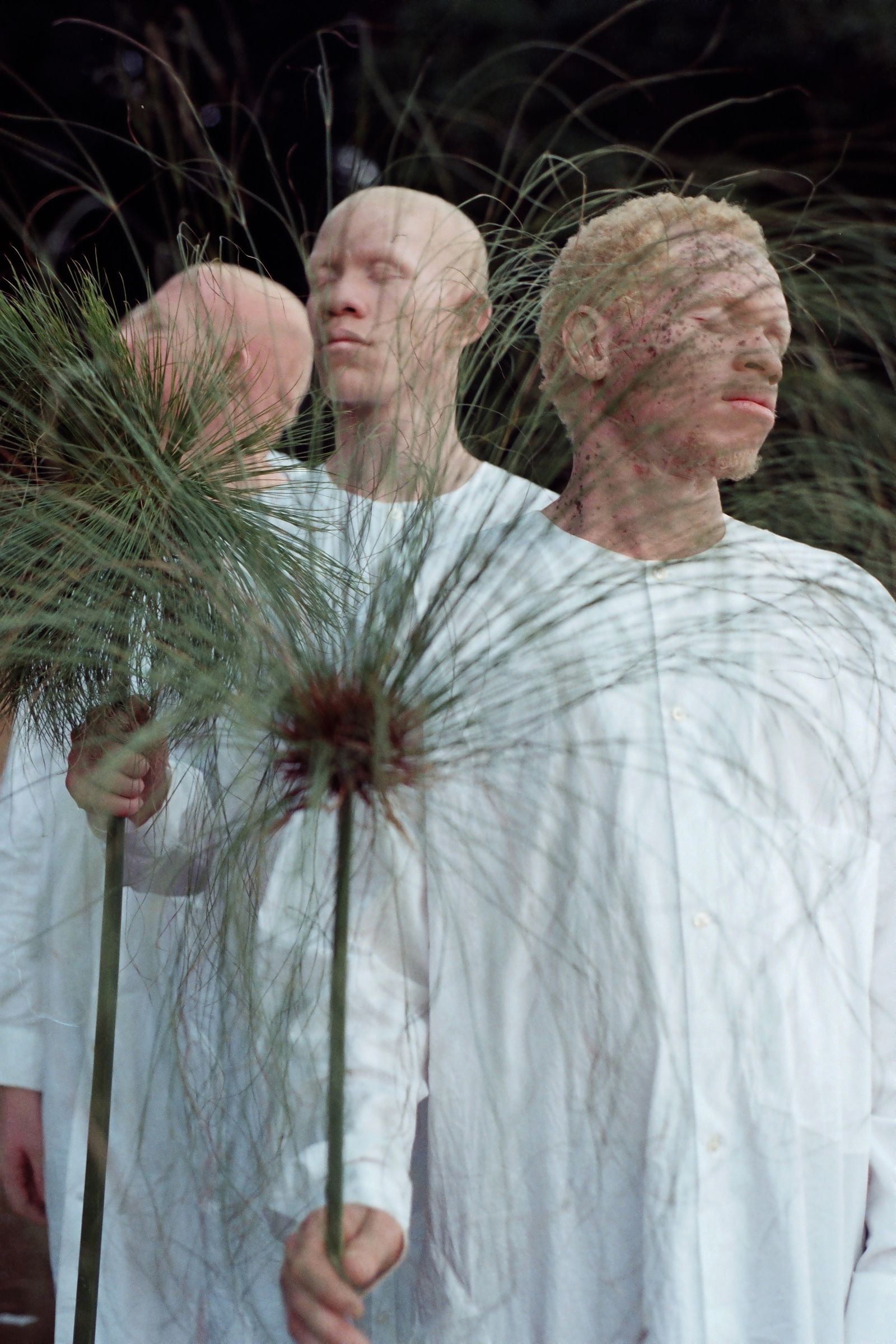 © Denisse Ariana Pérez - Image from the "Albinism, Albinism" Part I & II photography project