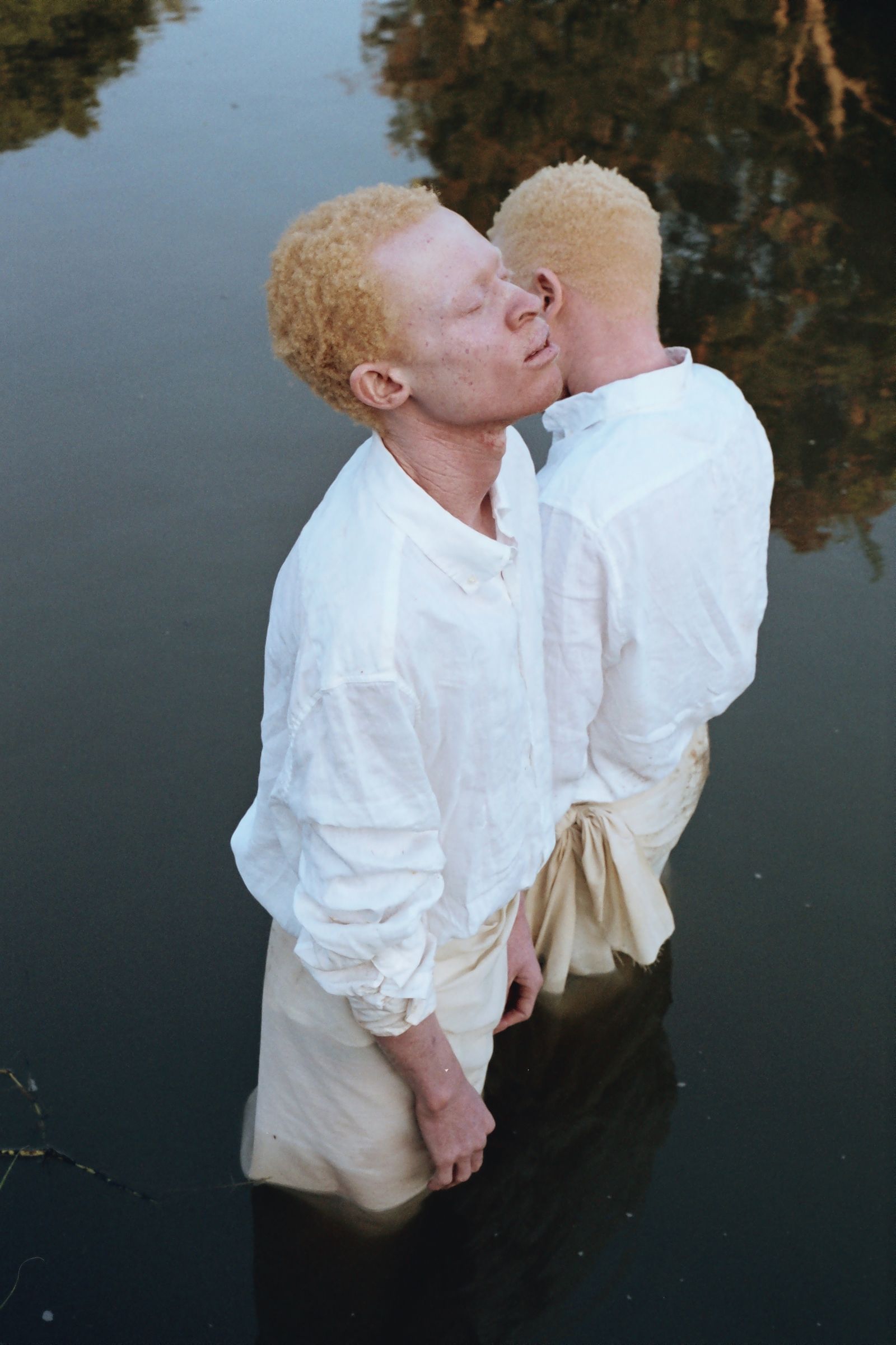 © Denisse Ariana Pérez - Image from the "Albinism, Albinism" Part I & II photography project