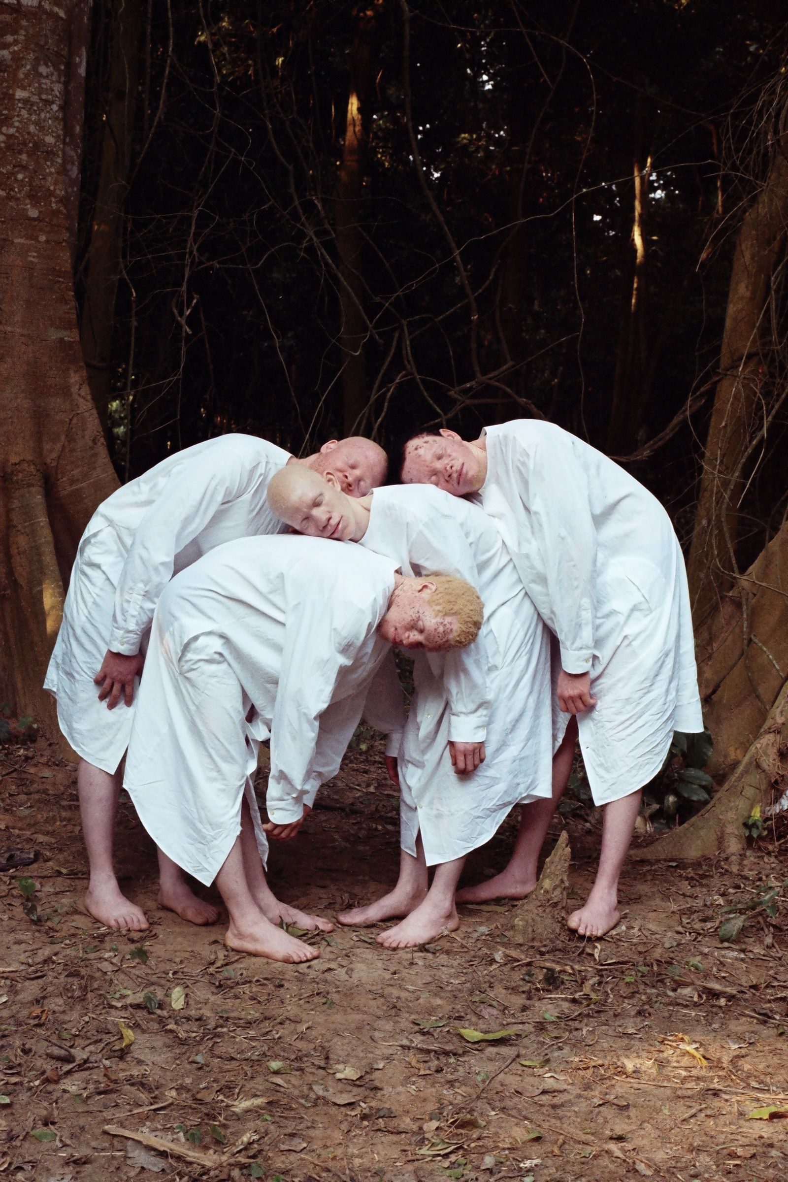 © Denisse Ariana Pérez - Image from the "Albinism, Albinism" Part I & II photography project