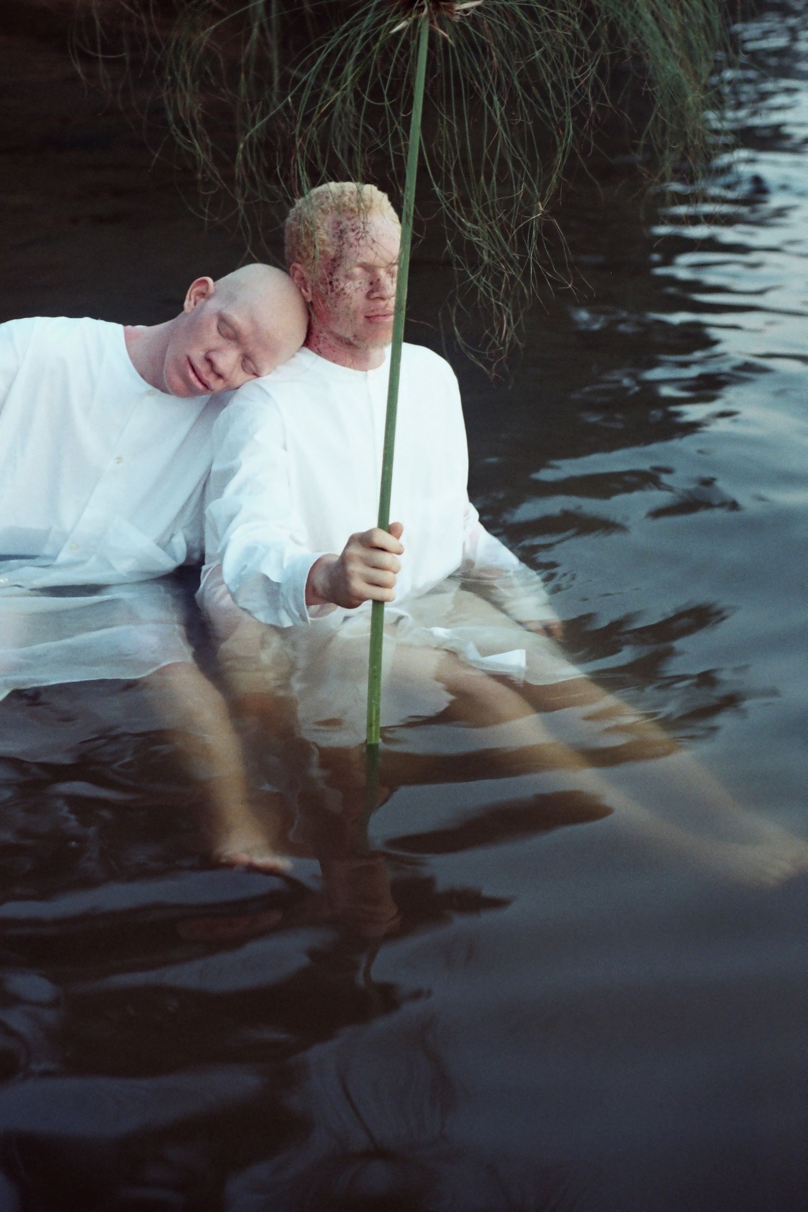 © Denisse Ariana Pérez - Image from the "Albinism, Albinism" Part I & II photography project