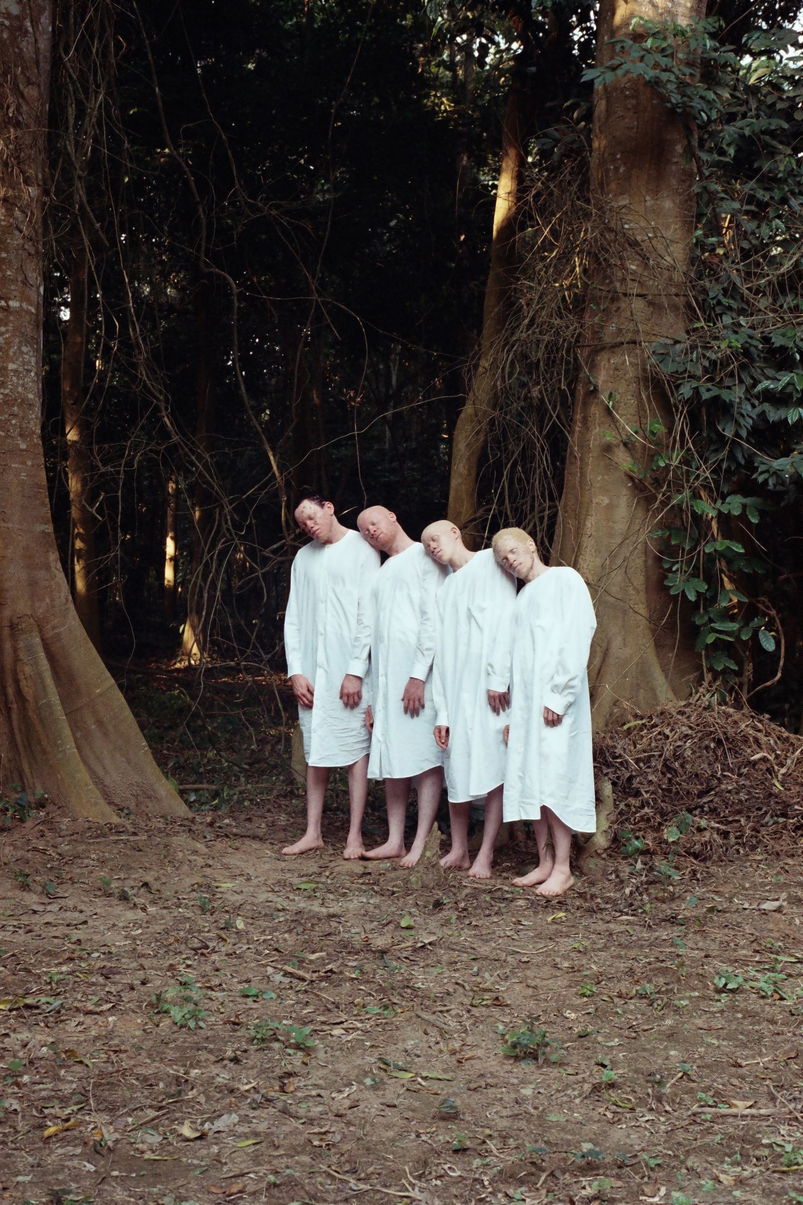 © Denisse Ariana Pérez - Image from the "Albinism, Albinism" Part I & II photography project