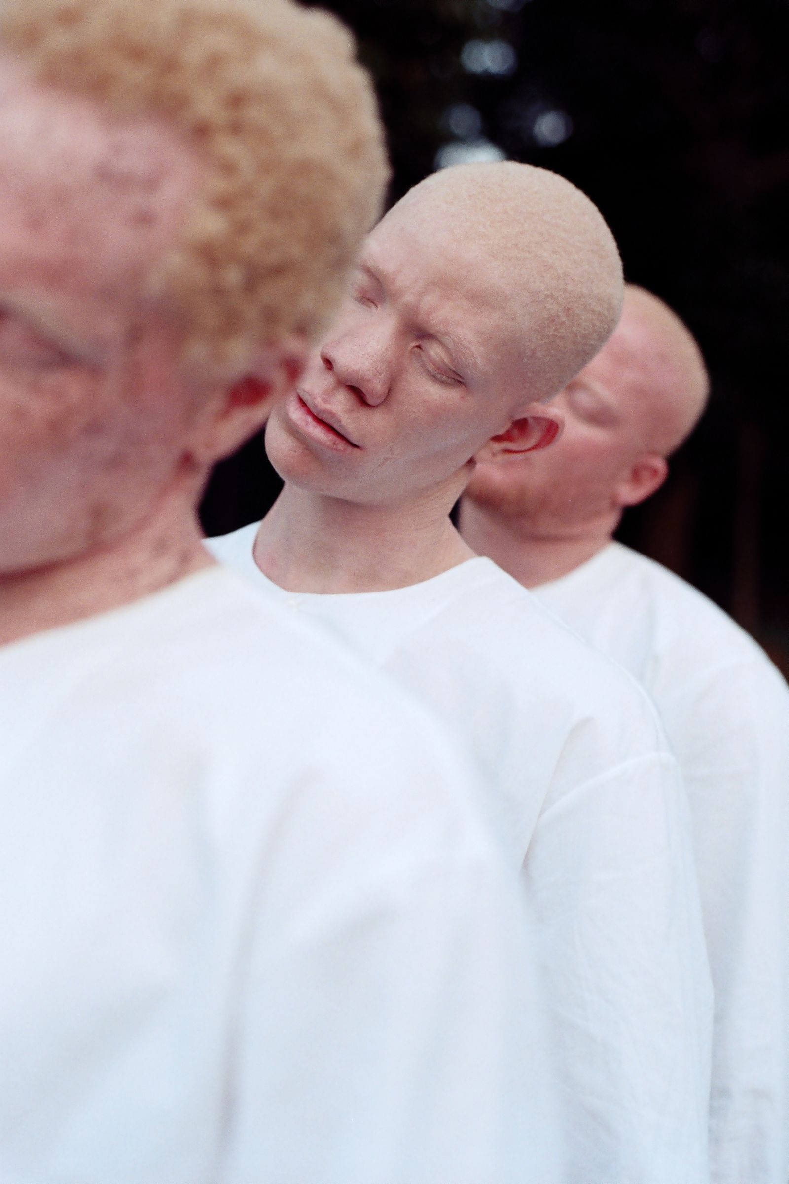 © Denisse Ariana Pérez - Image from the "Albinism, Albinism" Part I & II photography project