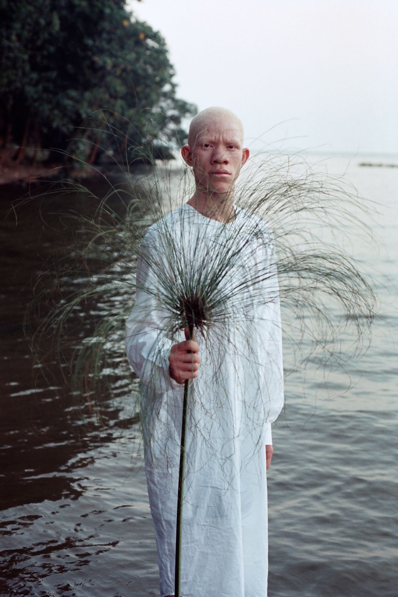 © Denisse Ariana Pérez - Image from the "Albinism, Albinism" Part I & II photography project