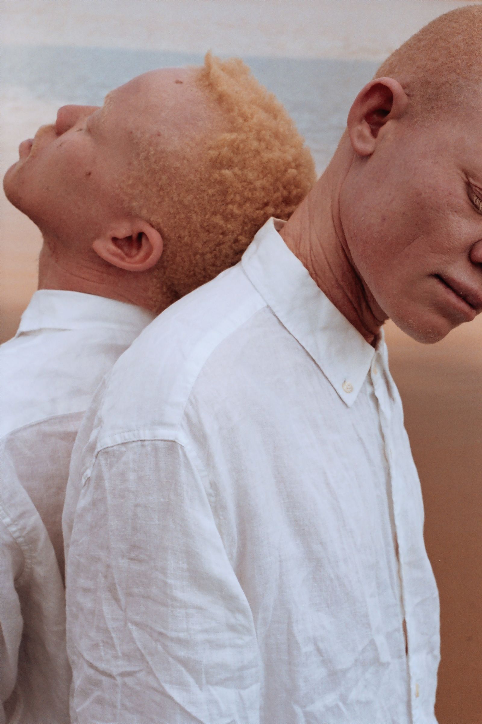 © Denisse Ariana Pérez - Image from the "Albinism, Albinism" Part I & II photography project