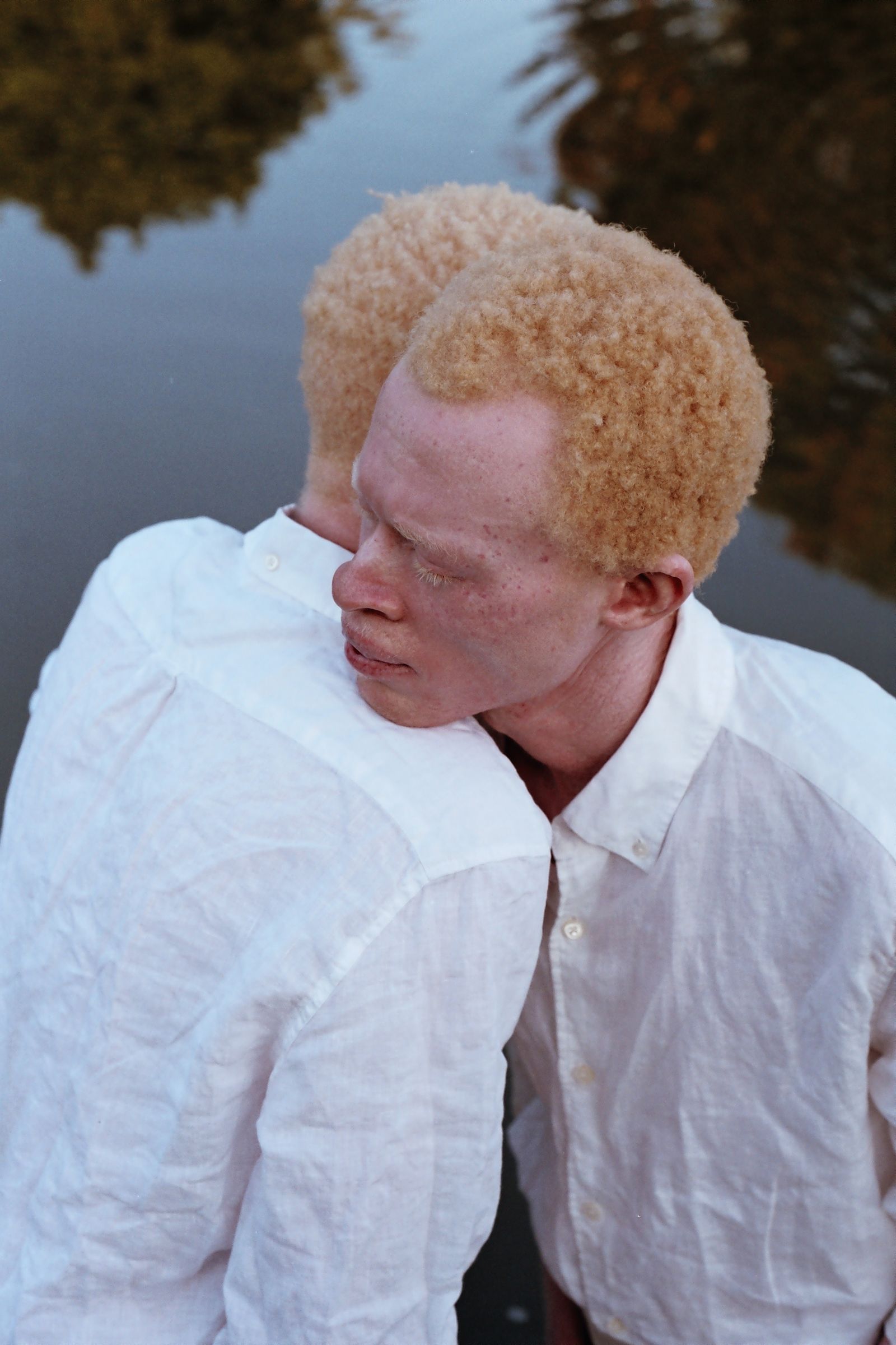 © Denisse Ariana Pérez - Image from the "Albinism, Albinism" Part I & II photography project